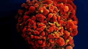Studie: mRNA-Impfstoff gegen HIV in Tierversuchen "vielversprechend"