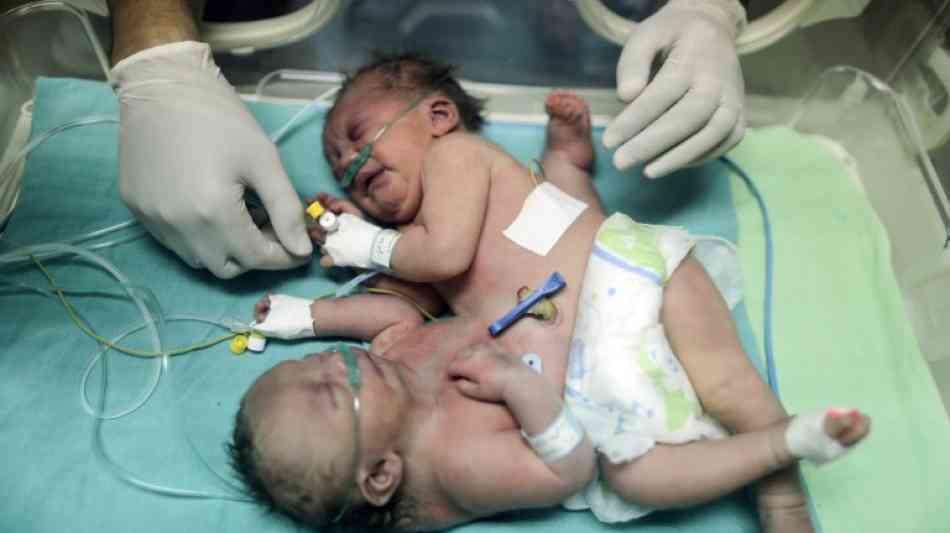 Siamesische Zwillinge im Gazastreifen geboren