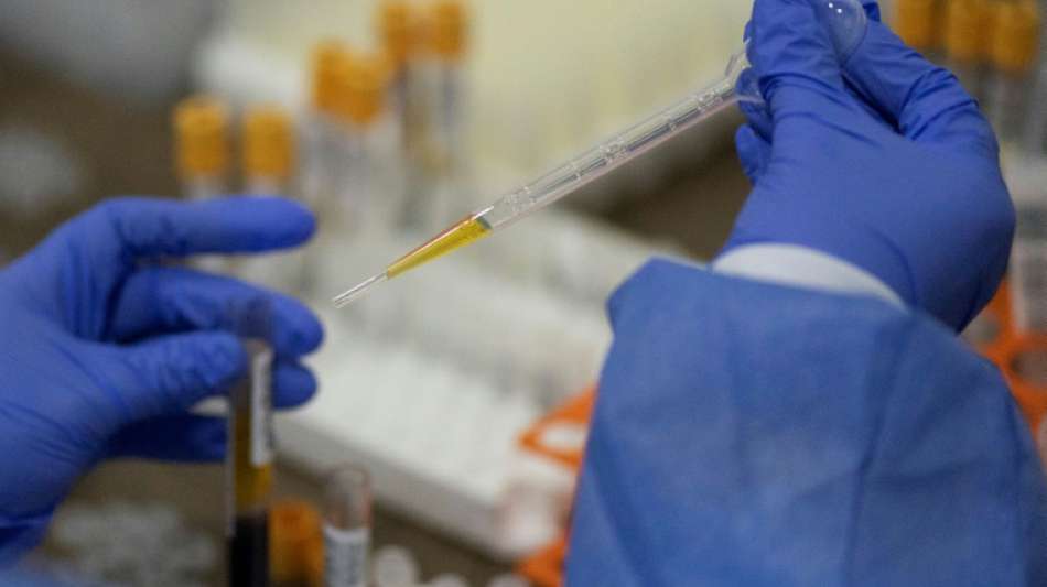 Johnson & Johnson gibt Wirksamkeit seines Impfstoffkandidaten mit 66 Prozent an