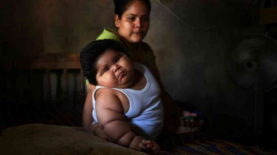 Gesundheit: Baby in Mexiko bringt 28 Kilo auf die Waage