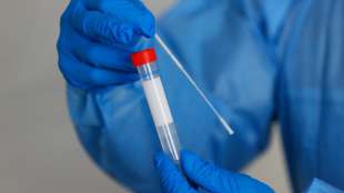 Dopingexperimente an DDR-Freizeitsportlern zugunsten der Stars