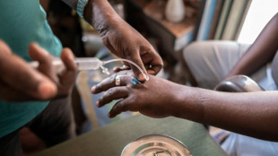 Farmacias informales, alternativa a tratamientos costosos en Rep&uacute;blica Centroafricana
