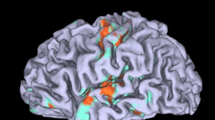 Riconoscuta nel cervello una spia delle malattie neurologiche
