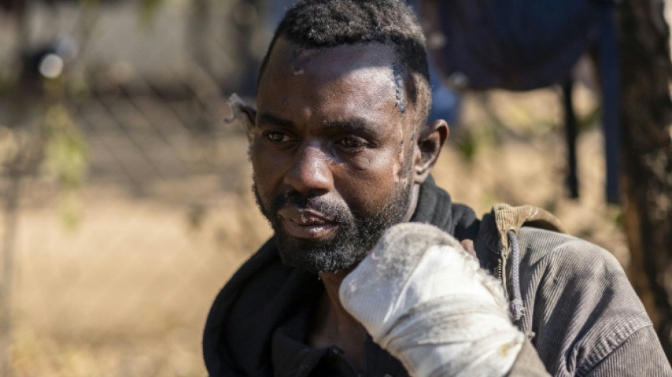  Soulagement et traumatismes pour les Zimbabw&eacute;ens fuyant les violences anti-migrants en Afrique du Sud 
