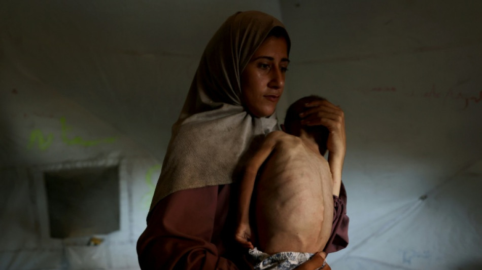 Un cuarto de los niños pequeños de Gaza sufren de malnutrición, afirma MSF