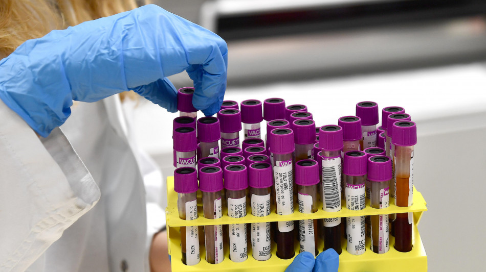 Alzheimer, nel sangue un timer che indica quando potr&agrave; manifestarsi