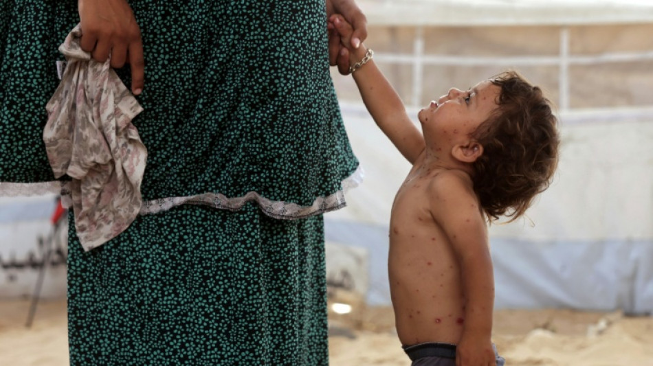  A Gaza, la varicelle de Rouba raconte la vie dans les camps de d&eacute;plac&eacute;s 