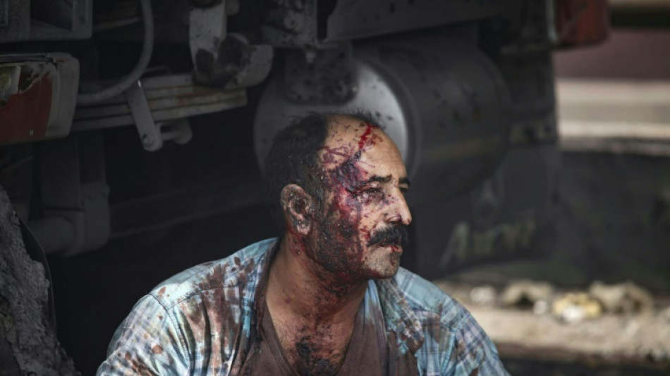 Eighteen killed, fires still burning in huge Iran port blast