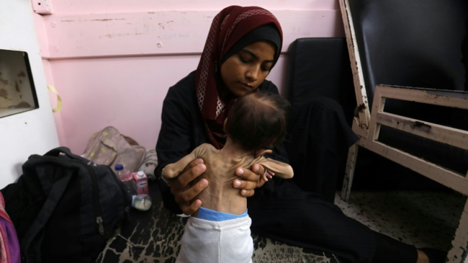 Ärzte ohne Grenze wirft Israel Einsatz von "Hunger als Waffe" vor