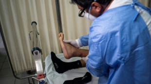 La OMS pide cautela tras transmisi&oacute;n de la viruela del mono de humano a perro