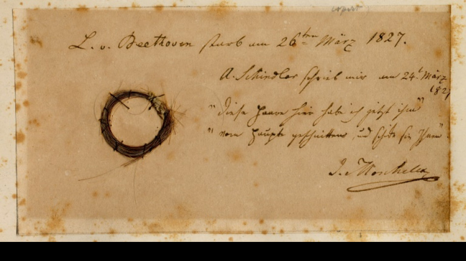 La mort de Beethoven &agrave; la lumi&egrave;re de son ADN