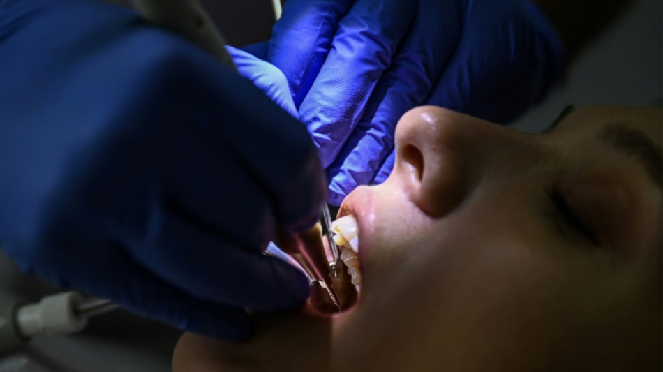 Les maladies bucco-dentaires touchent près de la moitié de la population mondiale (OMS)