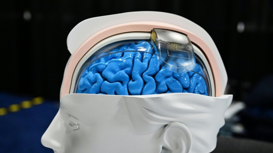 Revolução da neurotecnologia transforma ficção científica em realidade