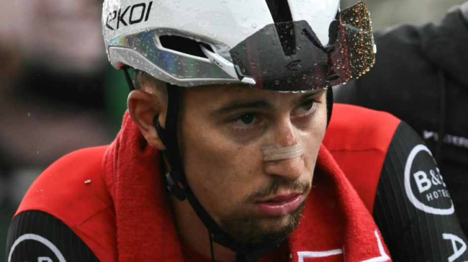 Cyclisme: Vauquelin bless&eacute; au niveau de la cheville en descendant un escalier