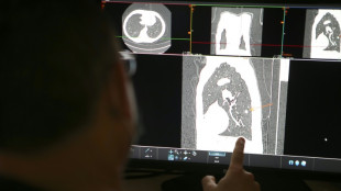 Poumon, cerveau, sein...: des nouvelles avanc&eacute;es notables dans la lutte contre le cancer 