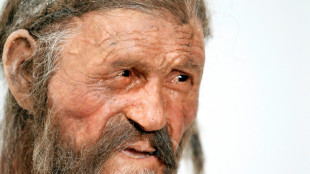 Ötzi, o 'homem das neves' era calvo e de pele mais escura do que se pensava