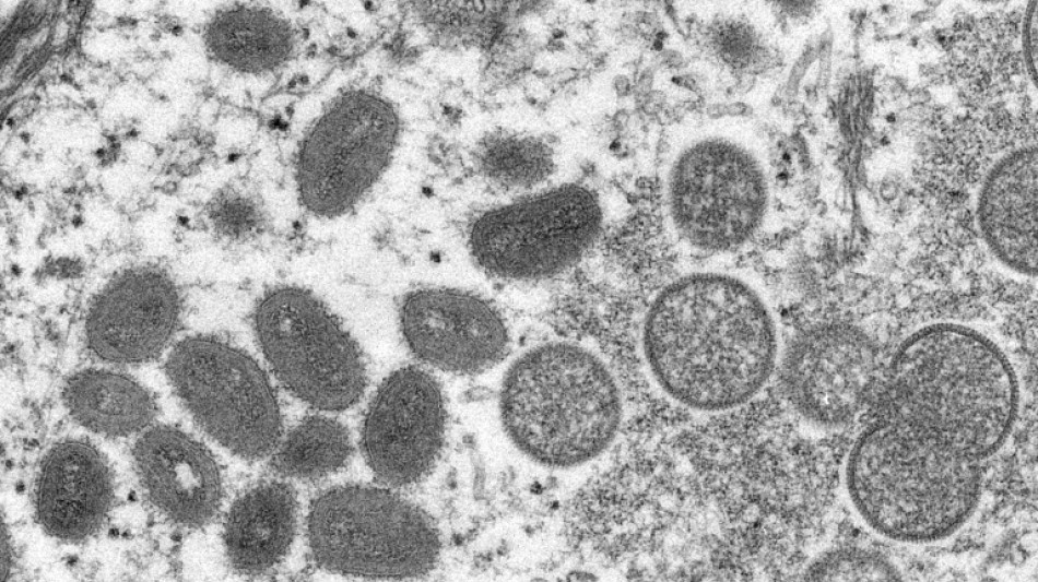 Variole du singe: des sympt&ocirc;mes plut&ocirc;t diff&eacute;rents chez les premiers cas europ&eacute;ens
