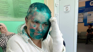 Russie: une journaliste d'investigation pass&eacute;e &agrave; tabac en Tch&eacute;tch&eacute;nie