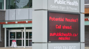 Los casos de sarampión en Canadá superan los 4.500, la cifra más alta en las Américas
