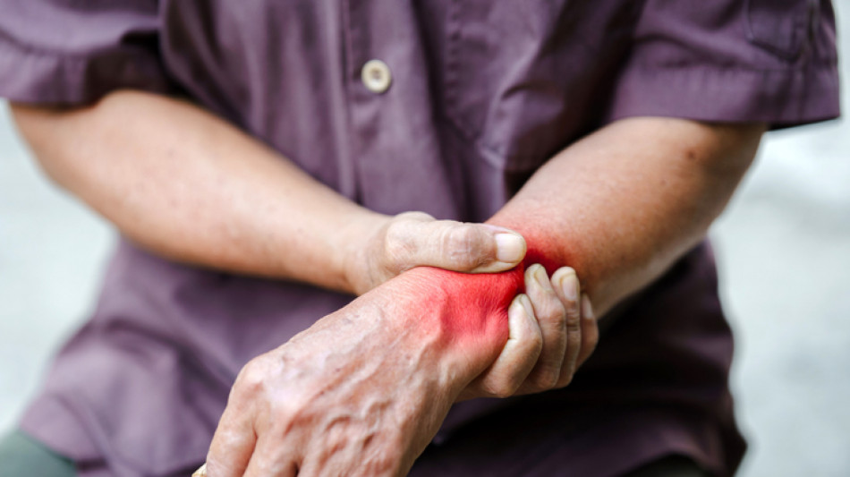  Malattie reumatologiche, diagnosi tardive e accesso alle cure sfide ancora aperte 