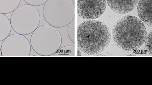 Distrofia muscolare, il 20 giugno 'M'illumino di arancione'