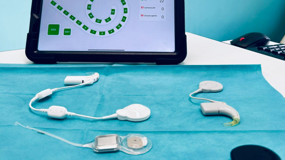 Al Policlinico di Bari impianto cocleare smart, bimbo di 11 recupera udito