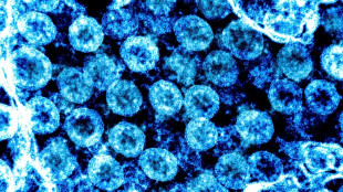 Studie: Coronaviren befallen nur wenige Lungenzellen