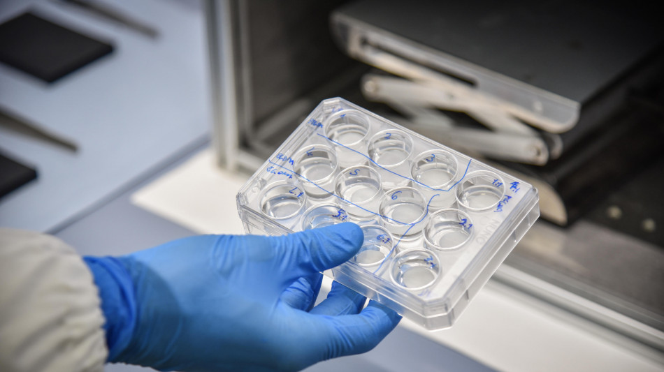  I guanti da laboratorio possono falsare gli studi sulle microplastiche 