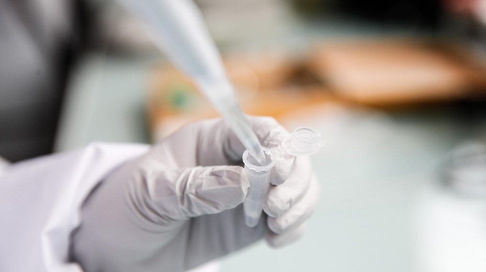  Melanoma, molecola mette il turbo a immunoterapia pre-intervento 