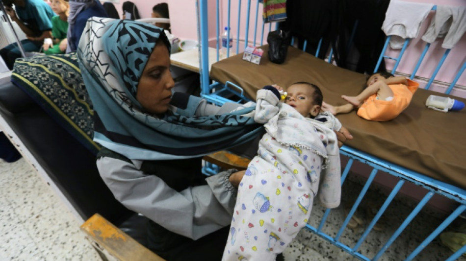 Des organisations humanitaires alertent sur la malnutrition infantile à Gaza