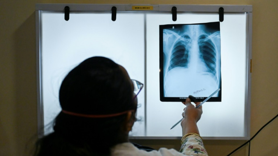 WHO: Weniger Todesfälle durch Tuberkulose dank mehr Diagnostik und Behandlung
