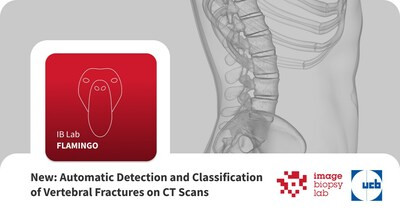 New: Automatic Detection and Classification of Vertebral Fractures on CT Scans